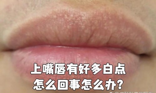 月经期间可以吃吗-月经期间可以吃卤制品网 :分享月经期间可以吃吗-月经期间可以吃卤制品吗女生知识